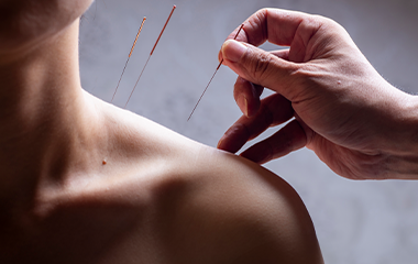 PPC and facebook ad strategies for acupuncturists