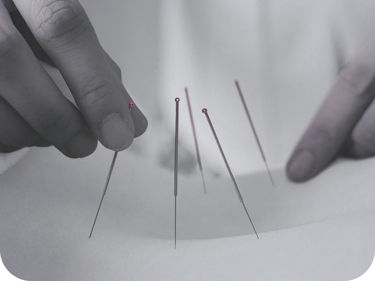 Acupuncture management software by Wellyx
